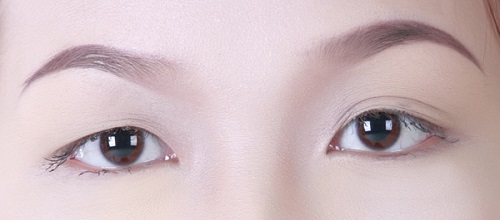 tạo mắt 2 mí 1 bên