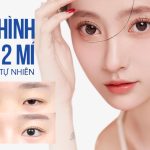 tạo mí mắt đôi