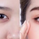 tạo mắt 2 mí sao cho đẹp