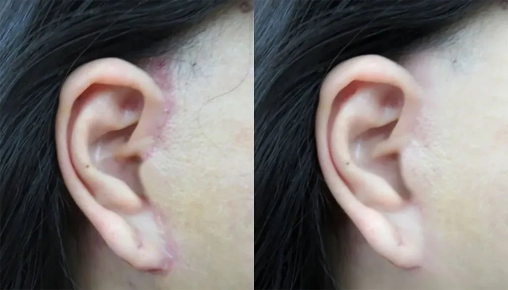 bác sĩ căng da mặt đẹp tại tphcm