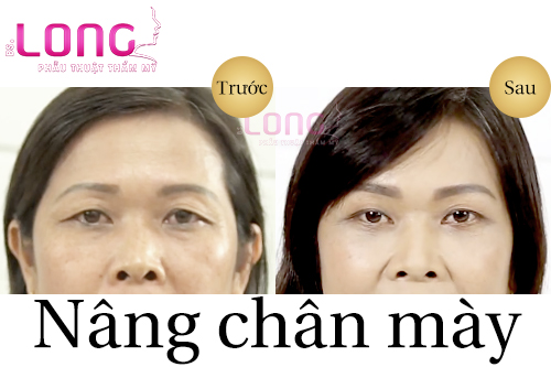 nang-chan-may-co-khac-phuc-tinh-trang-chay-xe-duoi-mat-khong-1