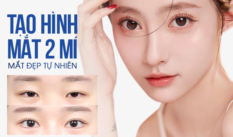 tạo mí mắt đôi