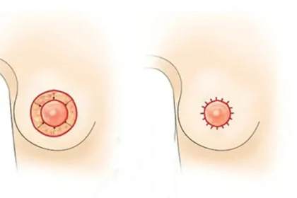 nang-nguc-duong-quang