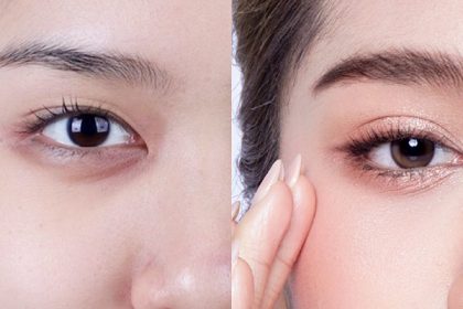 tạo mí mắt tự nhiên