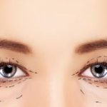 bac-si-tao-mi-mat-dep-va-uy-tin-tai-TPHCM4