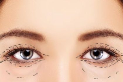 bac-si-tao-mi-mat-dep-va-uy-tin-tai-TPHCM4