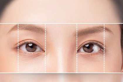 bác sĩ tạo mí mắt đẹp tại tphcm