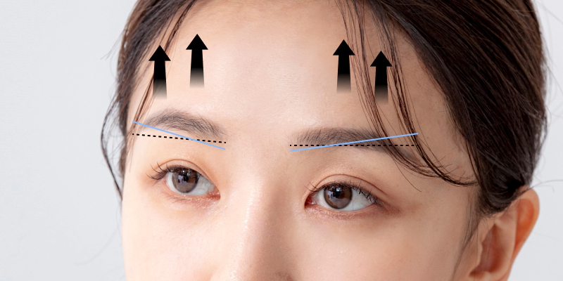 nâng cung chân mày có ảnh hưởng gì không