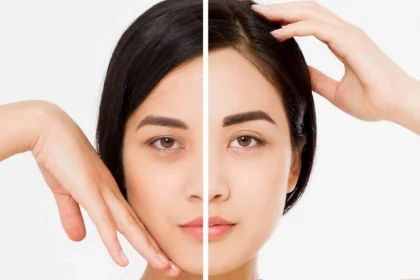 nâng chân mày trên là gì