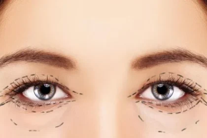 tạo mí đôi ở đâu đẹp tphcm