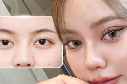 tạo mí mắt phượng