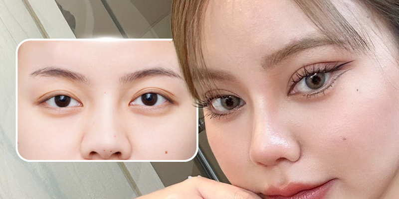 tạo mí mắt phượng