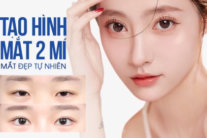 bác sĩ tạo mắt 2 mí đẹp tphcm