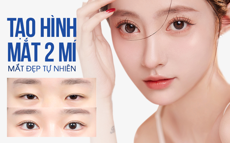 bác sĩ tạo mắt 2 mí đẹp tphcm