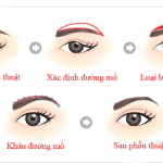 treo cung chân mày là gì