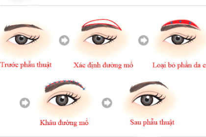 treo cung chân mày là gì