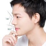 Nâng sống mũi nam giới