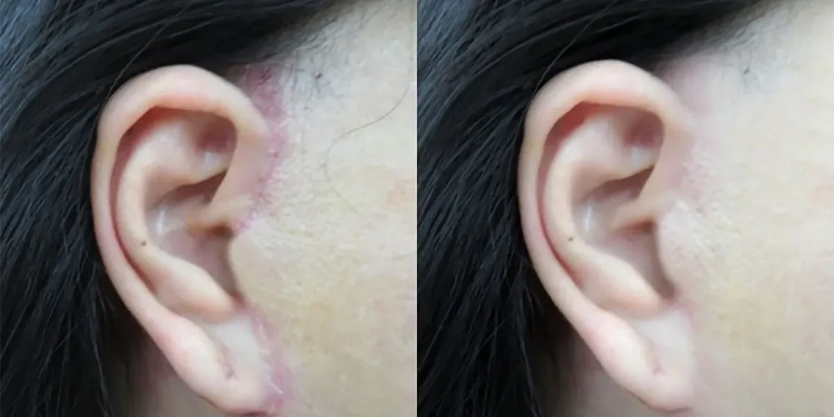 bác sĩ căng da mặt đẹp tại tphcm