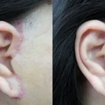 bác sĩ căng da mặt đẹp tại tphcm