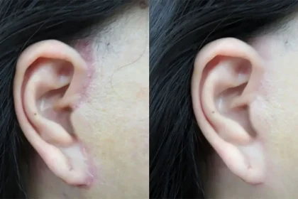 bác sĩ căng da mặt đẹp tại tphcm