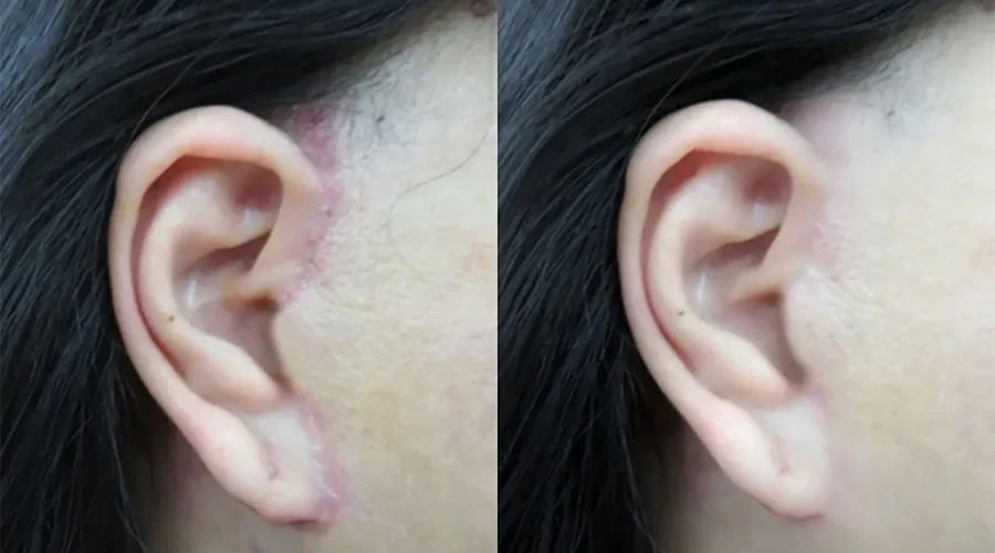 bác sĩ căng da mặt đẹp tại tphcm